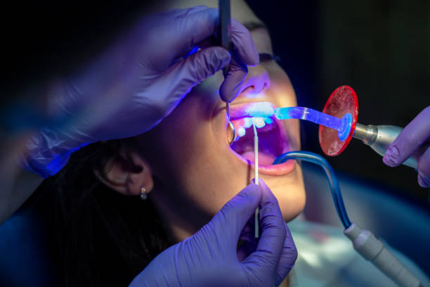 Laser Dentistry